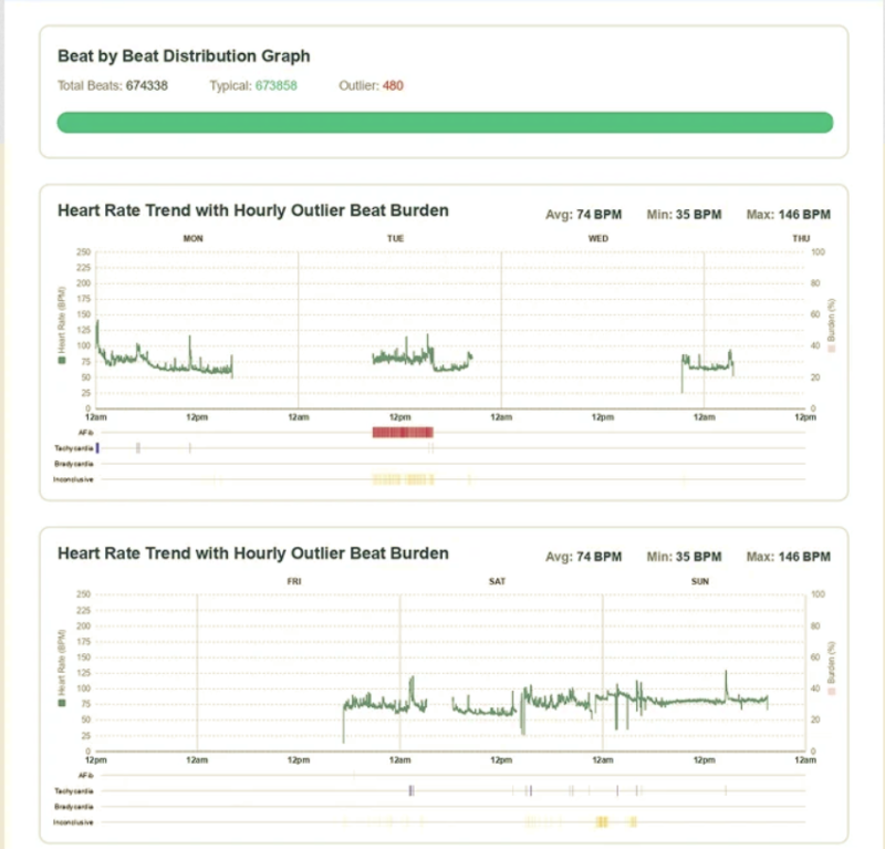 Fourth Frontier X Plus weekly report: beat-by-beat distribution and heart rate trend
