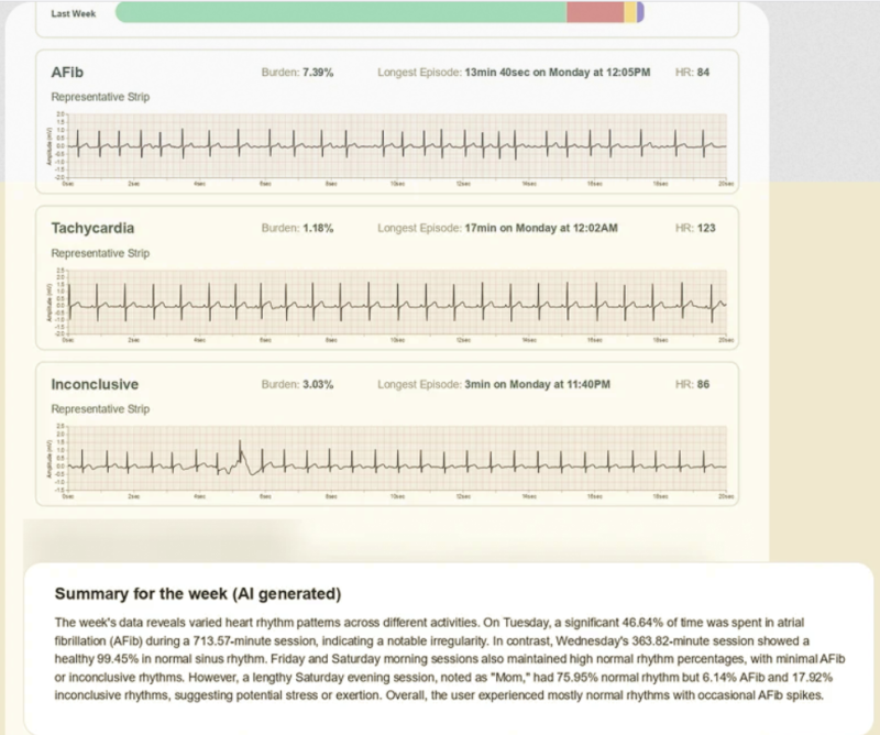 Fourth Frontier X Plus weekly cardiac rhythm report summary